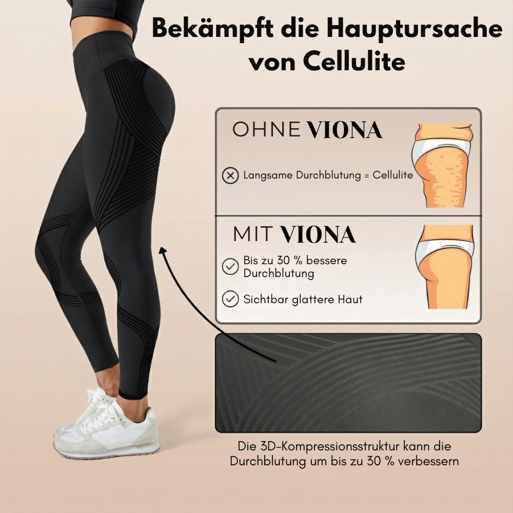3D Anti-Cellulite Leggings
