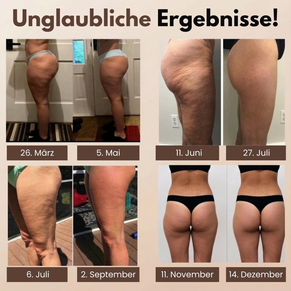 3D Anti-Cellulite Leggings