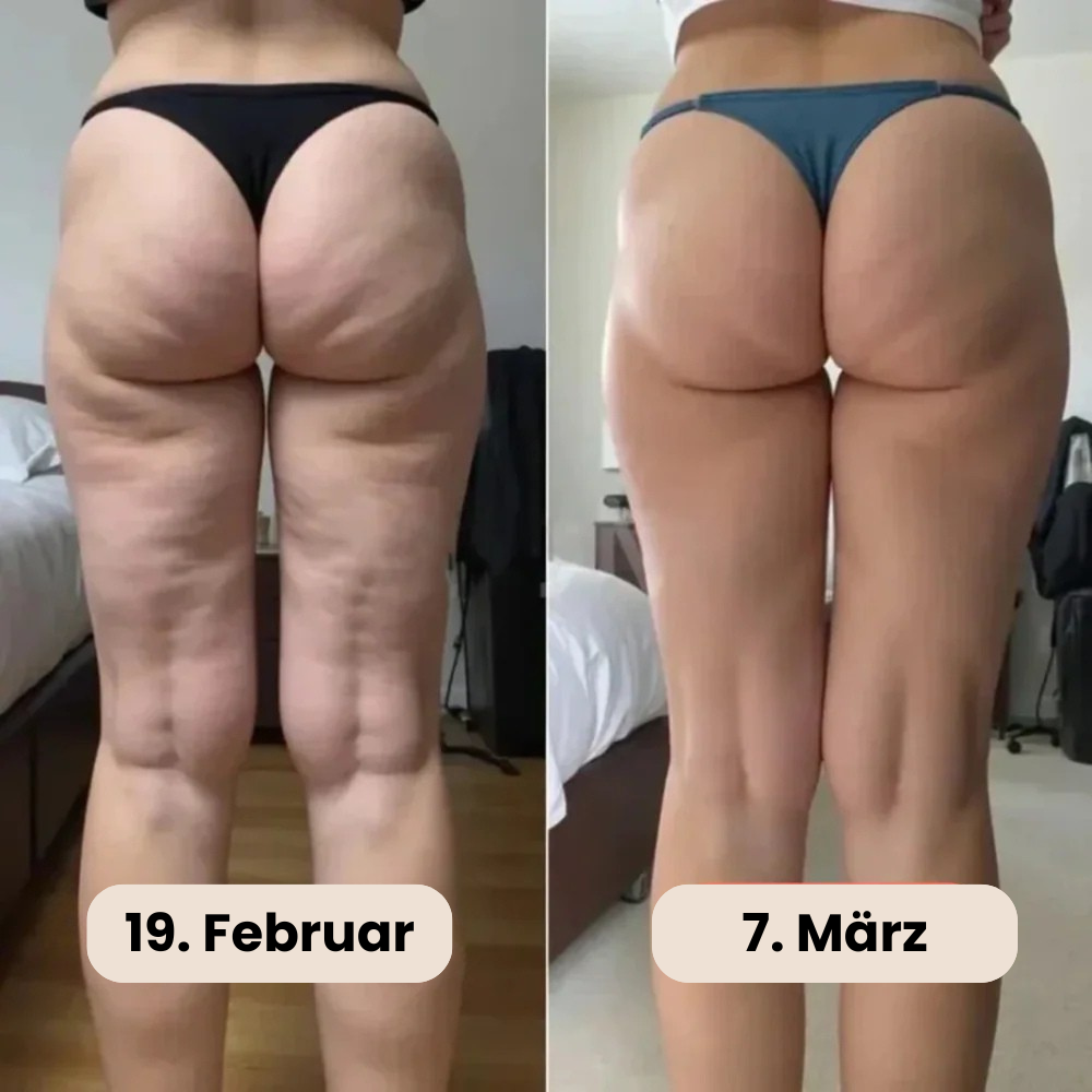 3D Anti-Cellulite Leggings